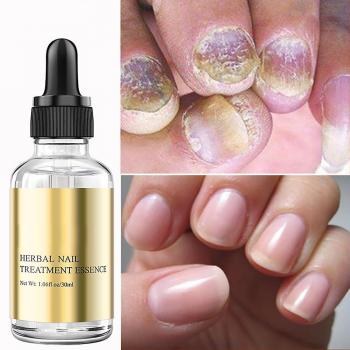Sérum réparateur pour les ongles faibles et endommagés