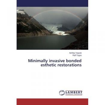 Yaqoob, Ashfaq: Minimally invasive bonded esthetic restorations