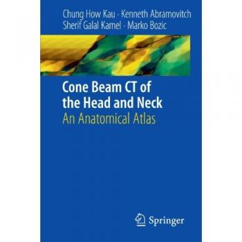 Cone Beam CT of the Head and Neck