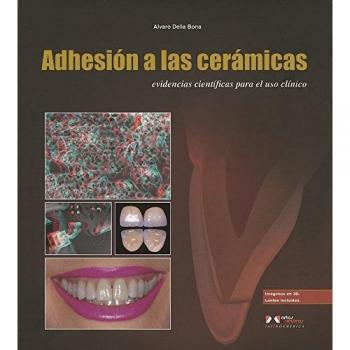 Della bona:adhesi—n a las cer‡micas: Evidencias científicas para el uso clínico en odontología.