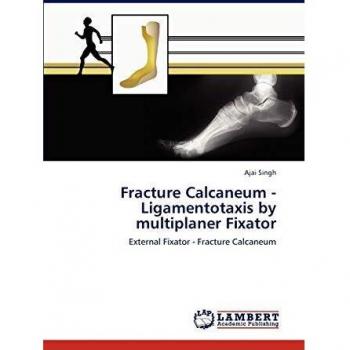 Fracture Calcaneum - Ligamentotaxis by multiplaner Fixator
