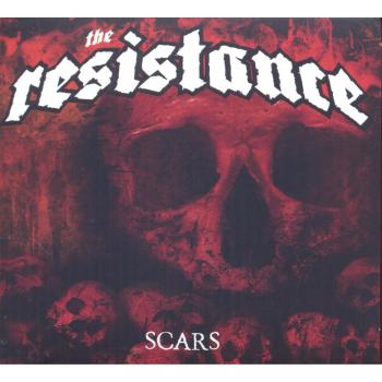 Scars