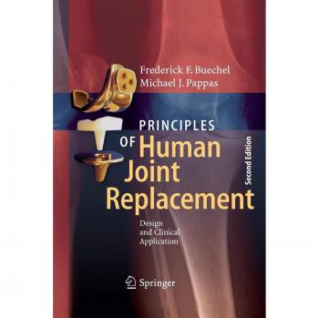 Principles of Human Joint Replacement: Design and Clinical Application