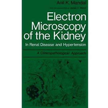 Electron Microscopy of the Kidney: In Renal Disease and Hypertension: A Clinicopathological Approach