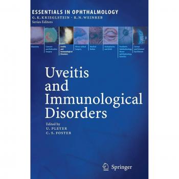 Uveitis and Immunological Disorders
