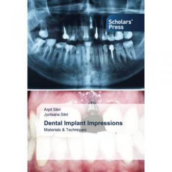 Dental Implant Impressions, Fachbücher von Arpit Sikri, Jyotsana Sikri
