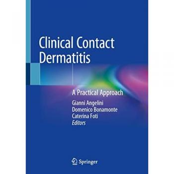 Clinical Contact Dermatitis