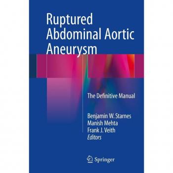 Ruptured Abdominal Aortic Aneurysm
