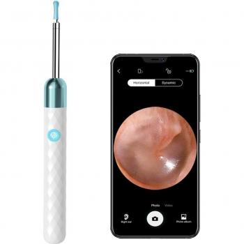 Otoscope Vision Connect