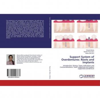 Support System of Overdentures: Roots and Implants