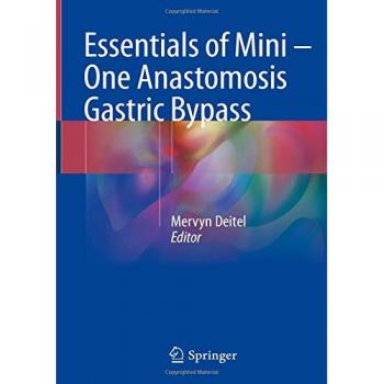 Essentials of Mini ‒ One Anastomosis Gastric Bypass