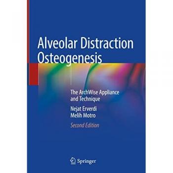 Alveolar Distraction Osteogenesis