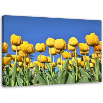 Tableau Floral Tulipes Jaunes 60x40