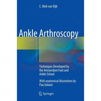 Dijk, C. Niek van: Ankle Arthroscopy