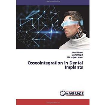 Osseointegration in Dental Implants