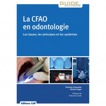 La CFAO en odontologie: bases, principes, systèmes
