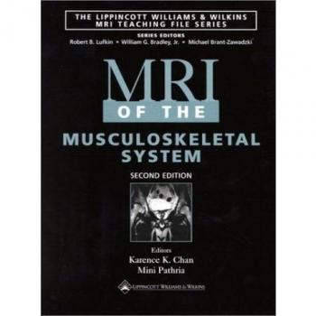 MRI of the Musculoskeletal System