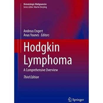 Hodgkin Lymphoma