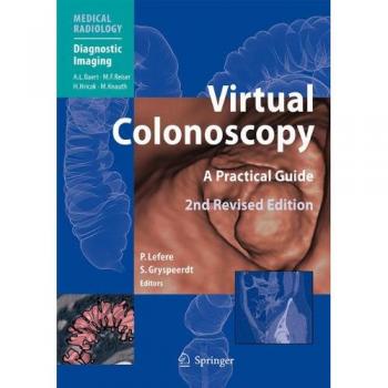 Virtual Colonoscopy