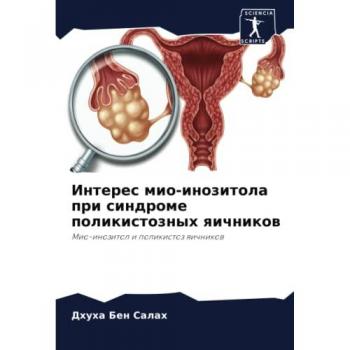 Интерес мио-инозитола при синдроме поликистозных яичников: Мио-инозитол и поликистоз яичников: Mio-inozitol i polikistoz qichnikow