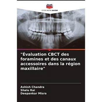 Chandra, Ashish: Évaluation CBCT des foramines et des canaux accessoires dans la région maxillaire
