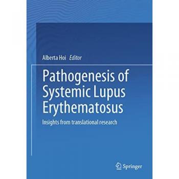 Pathogenesis of Systemic Lupus Erythematosus