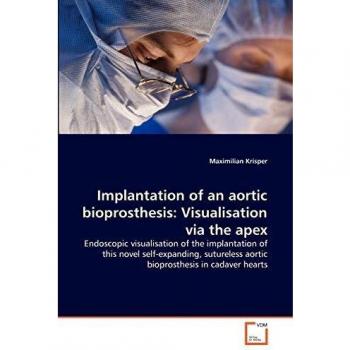 Implantation of an aortic bioprosthesis: Visualisation via the apex