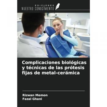 Memon, Rizwan: Complicaciones biológicas y técnicas de las prótesis fijas de metal-cerámica