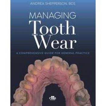 Managing tooth Wear. A comprehensive guide for general practice Andrea Shepperson