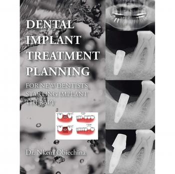 Dental Implant Treatment Planning for New Dentists Starting Implant Therapy
