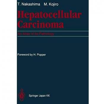 Hepatocellular Carcinoma