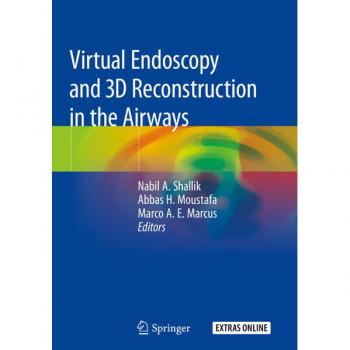 Virtual Endoscopy and 3D Reconstruction in the Airways