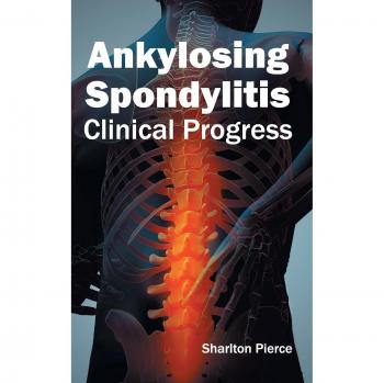 Ankylosing Spondylitis