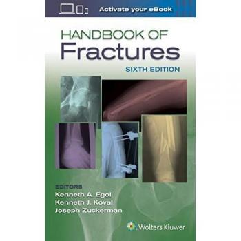 Lippincott Williams & Wilkins Handbook of Fractures