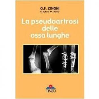 La pseudoartrosi delle ossa lunghe Gianfranco Zinghi