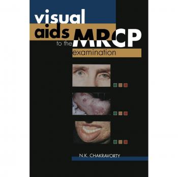 Chakravorty, N. K.: Visual Aids to the MRCP Examination