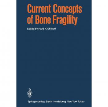 Current Concepts of Bone Fragility