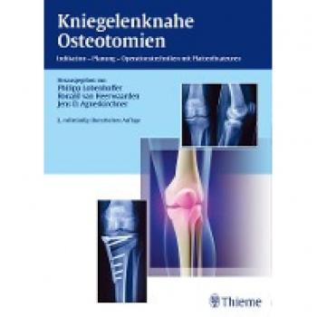 Kniegelenknahe Osteotomien