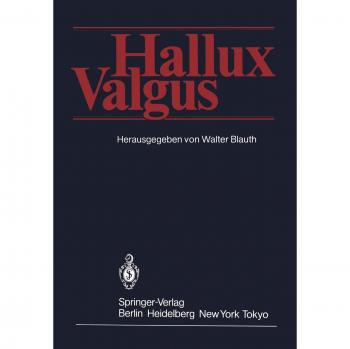 Hallux Valgus