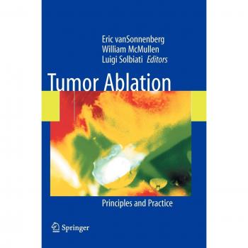 Tumor Ablation