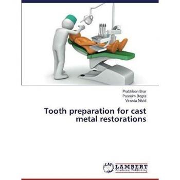 Tooth preparation for cast metal restorations