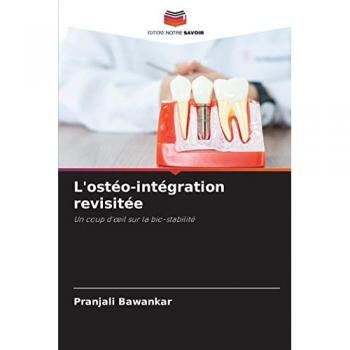 Bawankar, Pranjali: L'ostéo-intégration revisitée