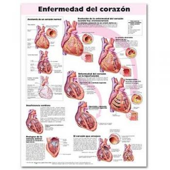 Heart Disease Anatomical Chart in Spanish