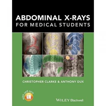 Abdominal X-rays for Medical Students