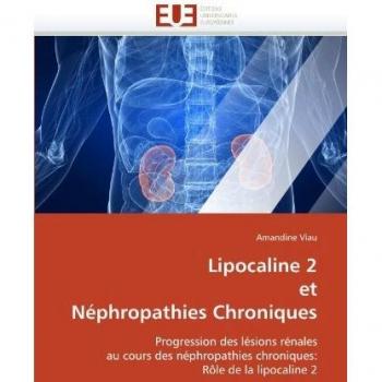 Lipocaline 2 et Néphropathies Chroniques: Progression des lésions rénales au cours des néphropathies chroniques: Rôle de la lipocaline 2