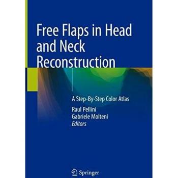 Free Flaps in Head and Neck Reconstruction: A Step-By-Step Color Atlas