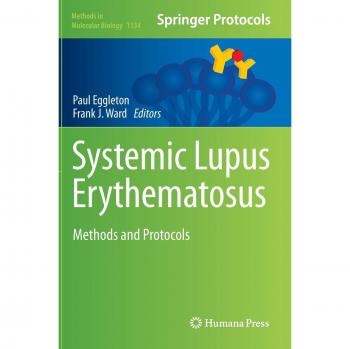 Systemic Lupus Erythematosus