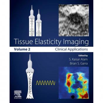 Vitalsource Technologies, Inc. Tissue Elasticity Imaging