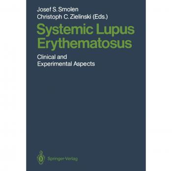 Systemic Lupus Erythematosus: Clinical and Experimental Aspects