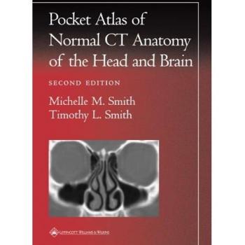 Pocket Atlas of Normal CT Anatomy of the Head and Brain by Timothy L. Smith
